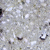 大曽層の流紋岩凝灰岩－火山礫凝灰岩<br>
            大曽層には凝灰岩が挟まれています。普通は細粒ですが、この写真のものは多くの軽石を含んでいます。<br>
            <br>
            Locality : 宇都宮市八幡山公園<br>